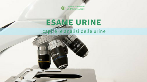 Esame Urine Capire Le Analisi Delle Urine Laboratorio Dr Derrico Angelo 0360